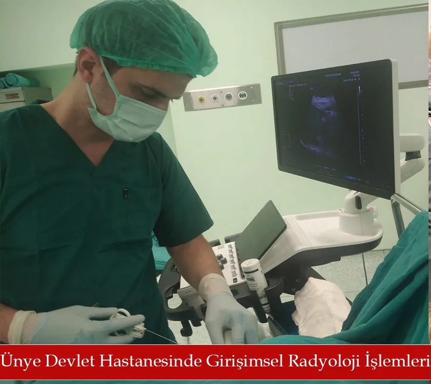 Ünye Devlet Hastanesinde Girişimsel Radyoloji işlemleri  yapılmaya başladı.